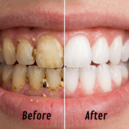 HydraPulse Oral Irrigator Advanced Multi-Mode Cleaning